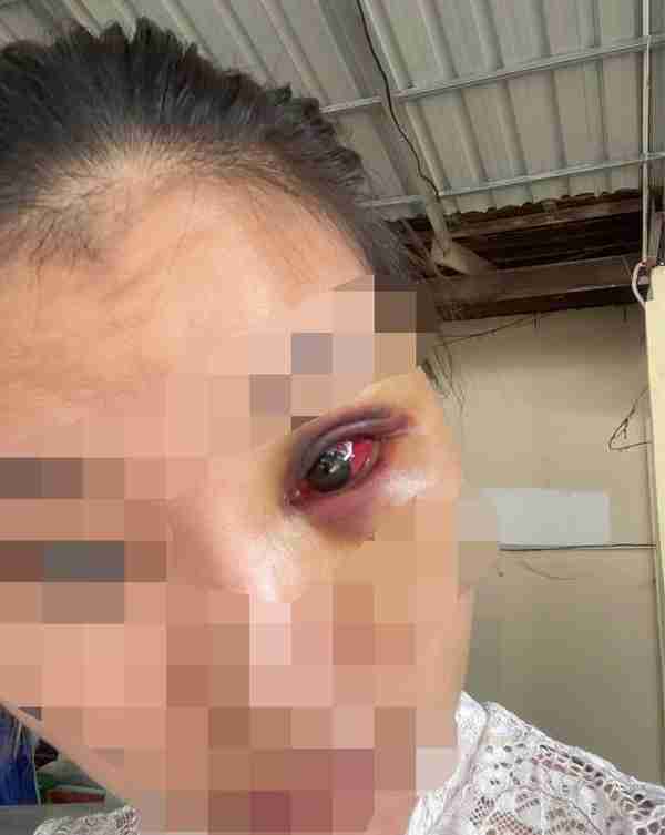 90后福建女子柬埔寨遭性侵殴打，装顺从逃出报警，女子至今被威胁“不翻供就报复”